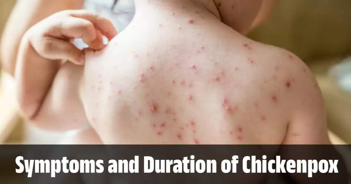 Symptoms and Duration of Chickenpox: A Quick Guide