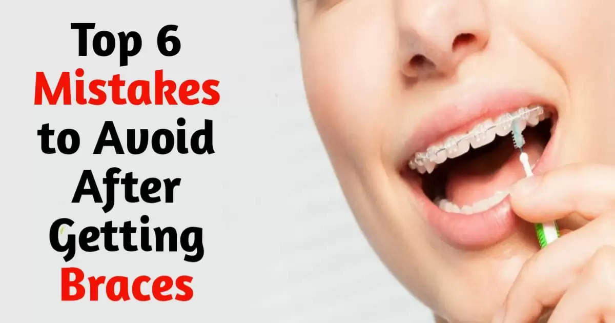 Braces Care: 6 Key Things to Remember