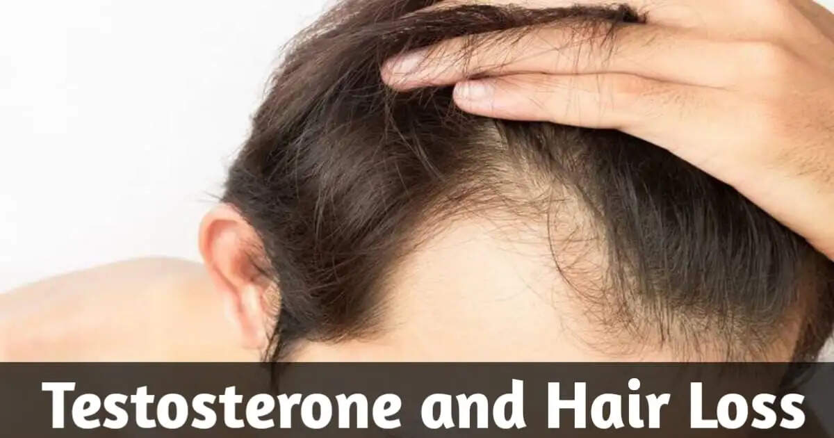 How Low Testosterone Levels Contribute to Hair Loss in Men