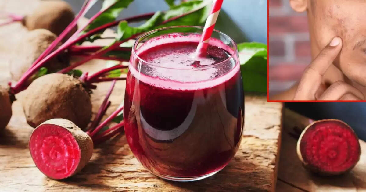 Beetroot: A Natural Solution for Men’s Acne and Skin Care