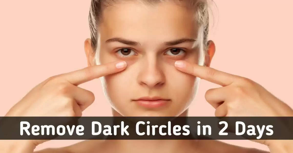 5 Natural Remedies to Reduce Dark Circles in 2 Days