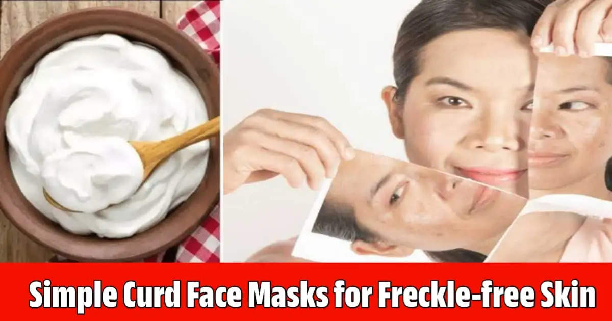 3 Simple Curd Face Masks for Glowing, Freckle-Free Skin