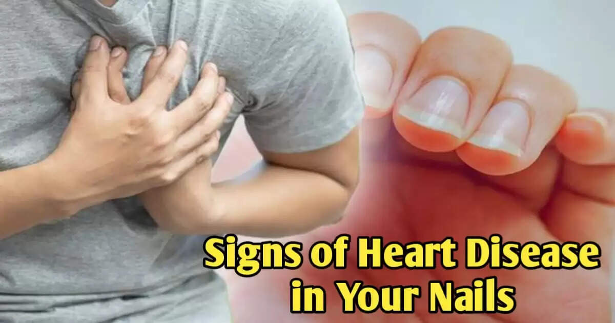 5 Nail Symptoms That Could Signal a Heart Attack