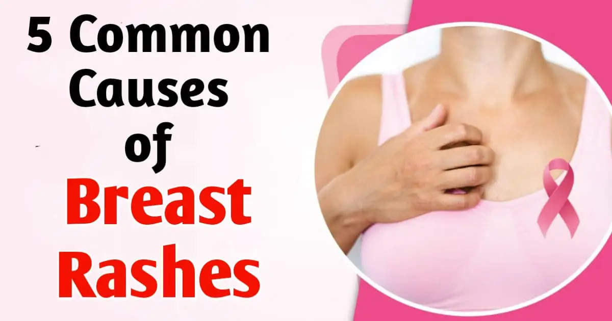 Understanding Breast Rashes: Top 5 Potential Causes