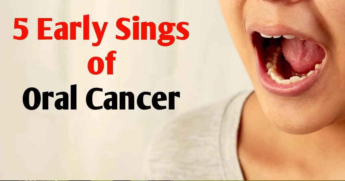 5 Early Signs of Oral Cancer: Watch for Teeth Changes